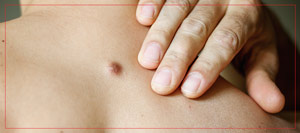 Cyst Removal Clinic Near Me in Crown Point, IN