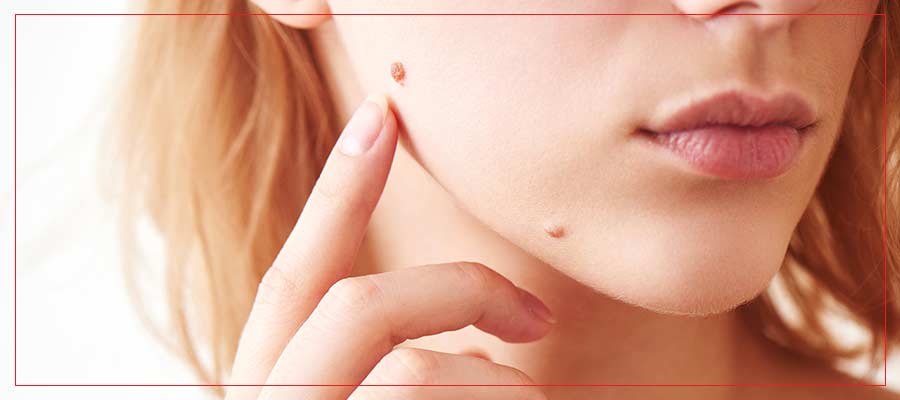 Mole Removal Services Near Me in Crown Point, IN