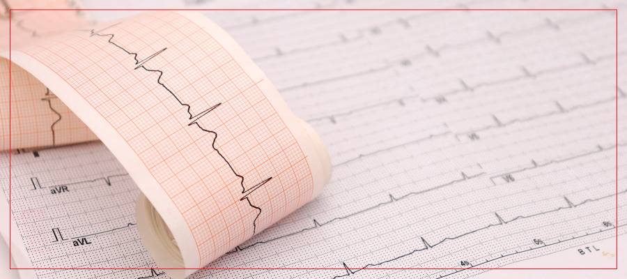 Cost of Electrocardiogram (EKG) Near Me in Crown Point, IN