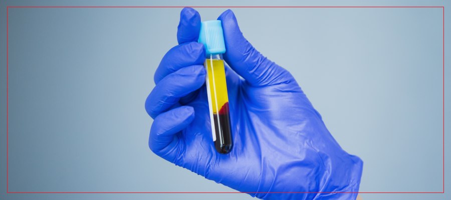 Who Is a Candidate for Platelet Concentrate Procedures in Crown Point, IN Who Is a Candidate for Platelet Concentrate Procedures in Crown Point, IN
