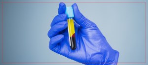 Who Is a Candidate for Platelet Concentrate Procedures in Crown Point, IN Who Is a Candidate for Platelet Concentrate Procedures in Crown Point, IN
